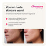 4in1 Skincare Red Light Therapy Wand