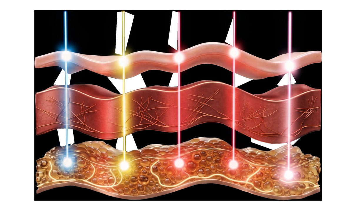 Cross-section of the skin layers showing the different penetration depths of blue, yellow, red, and near-infrared light